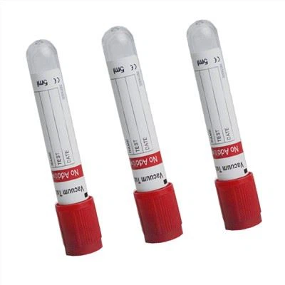 5ml Pet Clot Activator Vakuum Blood Collection Tube Produsent
